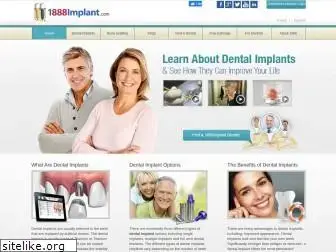 1888implant.com