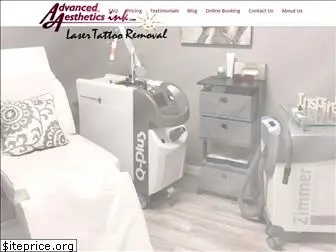 aailasertattooremoval.com