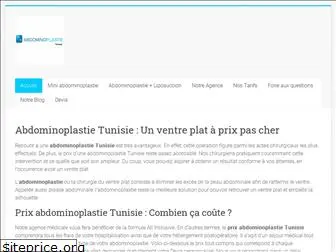 abdominoplastie-tunisie.com