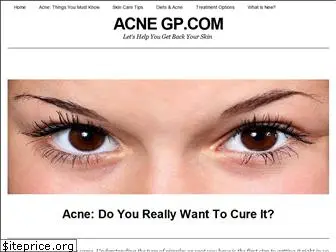 acne-gp.com