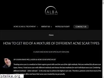 acne-scar-treatment.com