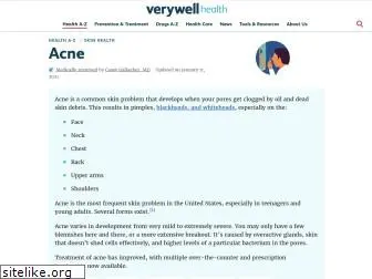 acne.about.com