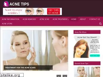 acnecleartips.com