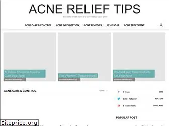 acnerelieftips.com