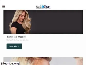 acneshoponline.com