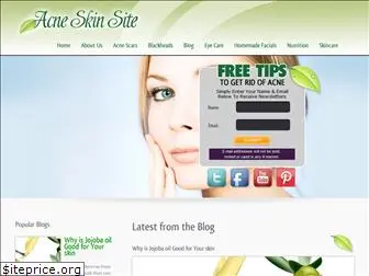 acneskinsite.com