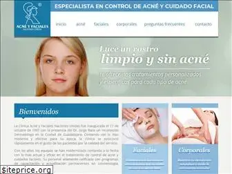 acneyfaciales.com.mx