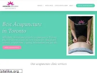 acupuncturecentertoronto.com