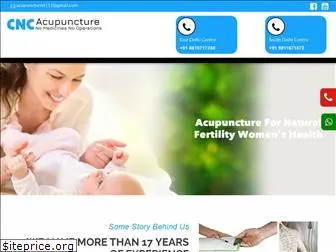 acupunctureclinicdelhi.com