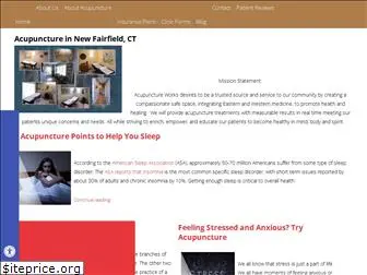acupuncturefeelsgood.com