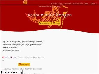 acupunctuurdongen.nl
