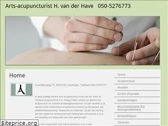 acupunctuurgroningen.com