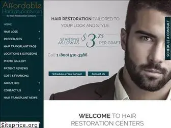 affordablehairtransplants.com