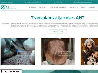 ahttransplantacijakose.com