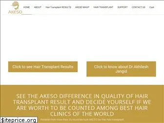 akesohairtransplant.com