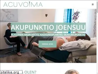 akupunktiojoensuu.fi
