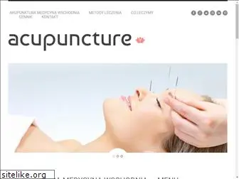 akupunktura-medycyna-wschodnia.pl