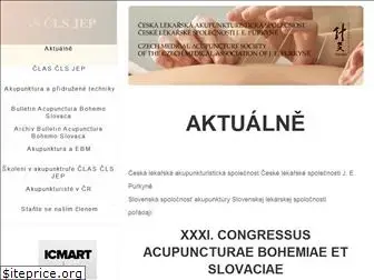 akupunktura.cz