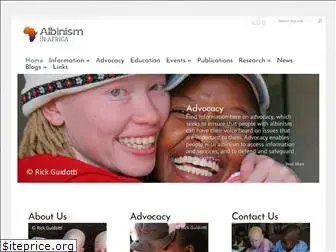 albinism-in-africa.com