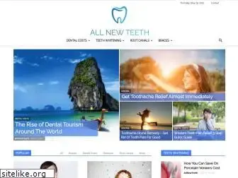 allnewteeth.com