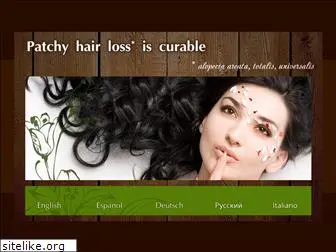 alopecia-areata.com