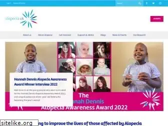 alopecia.org.uk