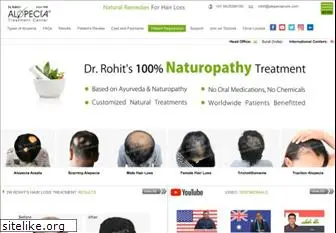 alopeciacure.com