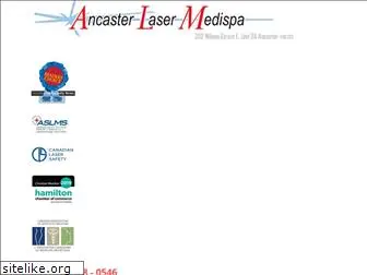 ancasterlaser.ca