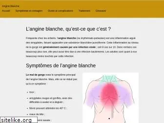angine-blanche.com