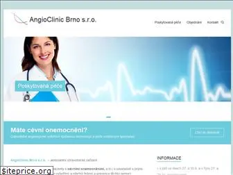 angioclinicbrno.cz