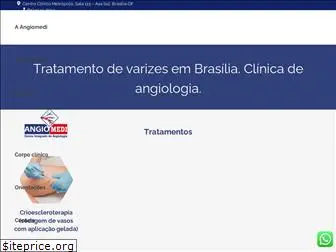 angiomedi.com.br