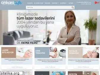 ankaralazer.com