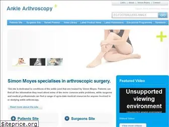 ankle-arthroscopy.co.uk