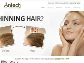 antechhair.ca