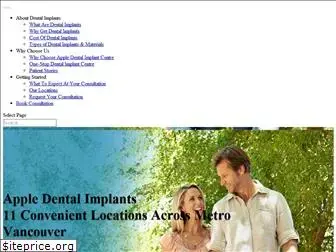 appledentalimplantcentre.com