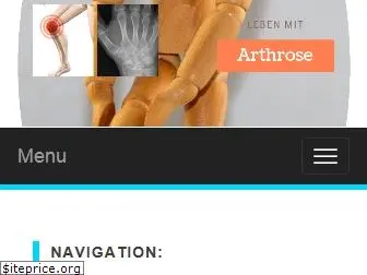 arthrose.seliweb.de