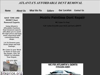 atlantasdentremoval.com