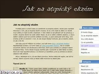 atopicky-ekzem.net