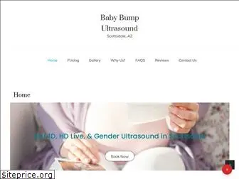 babybumpultrasound.com