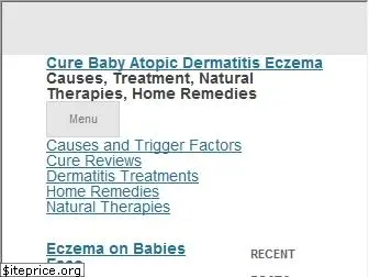 babydermatitis.com