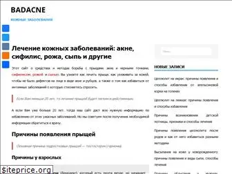 badacne.ru