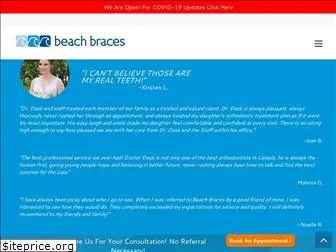 beachbraces.ca