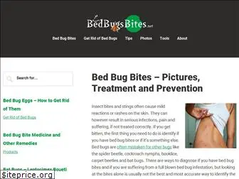 bedbugsbites.net