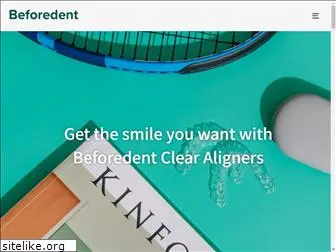 beforedent.com