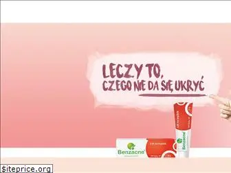 benzacne.pl