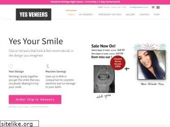 bestcliponveneers.co.uk