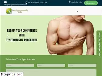 bestgynecomastiaindia.com