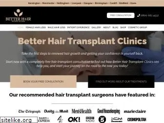 betterhairtransplantclinics.co.uk