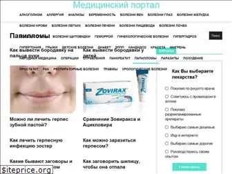 bezpapillom.ru