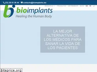 bioimplants.mx